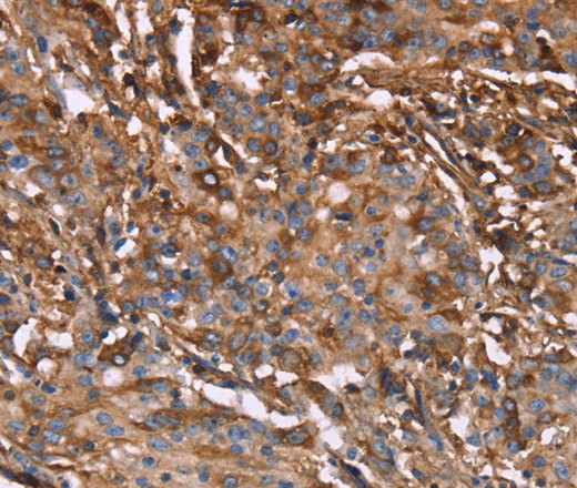 HP Polyclonal Antibody (E-AB-16489)
