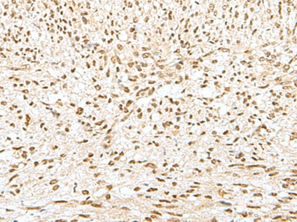 GTF2A2 Polyclonal Antibody (E-AB-18882)