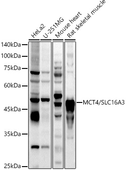 MCT4/SLC16A3 Polyclonal Antibody (E-AB-90202)