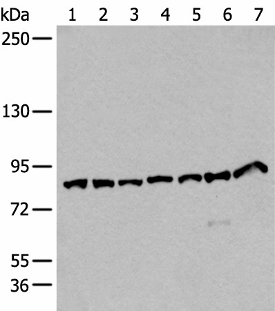 VPS35 Polyclonal Antibody (E-AB-19592)
