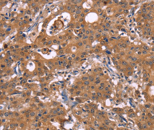 HMGCS1 Polyclonal Antibody (E-AB-16482)