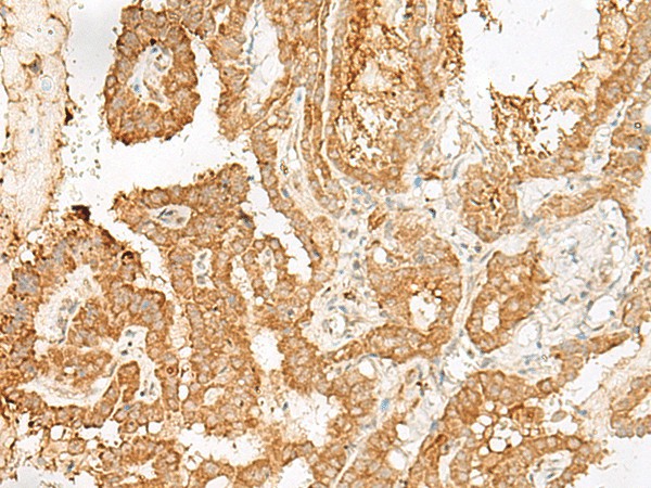 ADGRF1 Polyclonal Antibody (E-AB-19929)