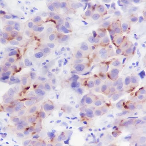 Recombinant Phospho-Girdin (Tyr1765) Monoclonal Antibody (AN302074L)