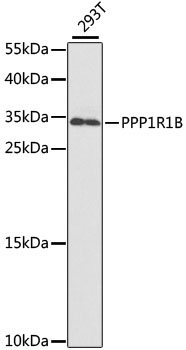 PPP1R1B Polyclonal Antibody (E-AB-67477)