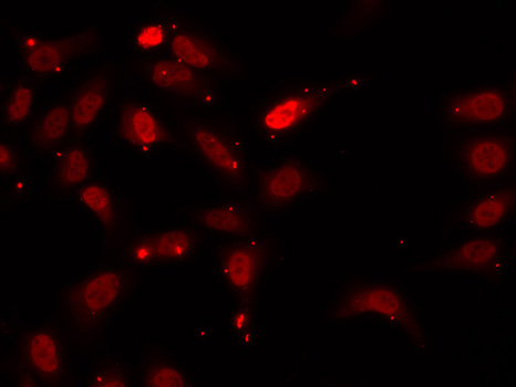 (KO Validated) HNRNPF Polyclonal Antibody (E-AB-60999)