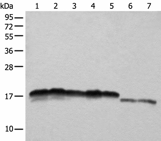 NDUFB11 Polyclonal Antibody (E-AB-18334)