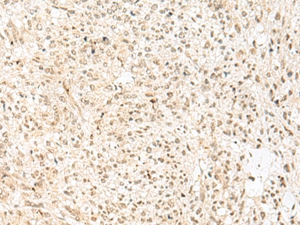 RBX1 Polyclonal Antibody (E-AB-18881)