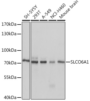 SLCO6A1 Polyclonal Antibody (E-AB-91014)