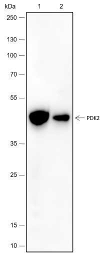 Recombinant PDK2 Monoclonal Antibody (AN301725L)