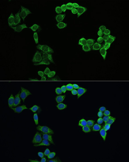 APP Polyclonal Antibody (E-AB-68269)