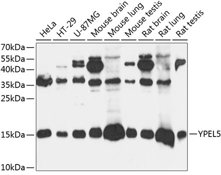 YPEL5 Polyclonal Antibody (E-AB-90806)