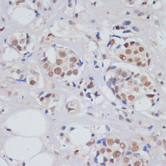 SKIV2L2 Polyclonal Antibody (E-AB-61020)