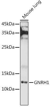 GNRH1 Polyclonal Antibody (E-AB-68373)