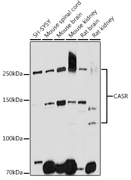CASR Polyclonal Antibody (E-AB-90771)