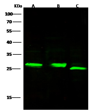 Recombinant Adipsin/Complement Factor D/CFD Monoclonal Antibody (AN300533P)