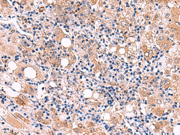 LIPA Polyclonal Antibody (E-AB-52935)