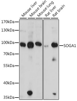 SOGA1 Polyclonal Antibody (E-AB-66868)