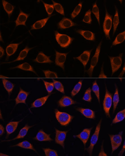 CTNNA3 Polyclonal Antibody (E-AB-66840)