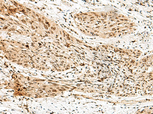RBM15 Polyclonal Antibody (E-AB-18870)