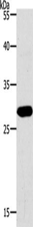 PAX5 Polyclonal Antibody (E-AB-12615)