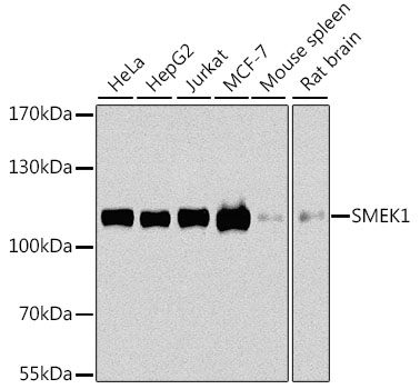 SMEK1 Polyclonal Antibody (E-AB-62484)