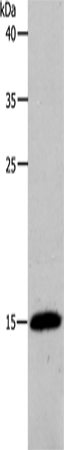 PFN2 Polyclonal Antibody (E-AB-12624)