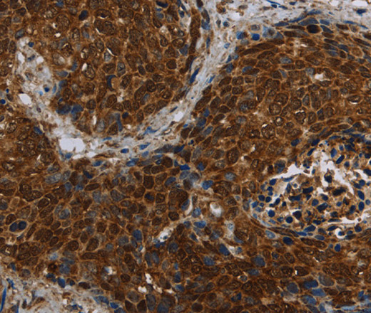 CERS5 Polyclonal Antibody (E-AB-13376)