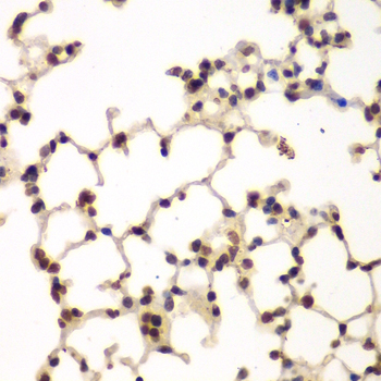PRKCB Polyclonal Antibody (E-AB-64756)
