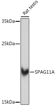 SPAG11A Polyclonal Antibody (E-AB-92113)