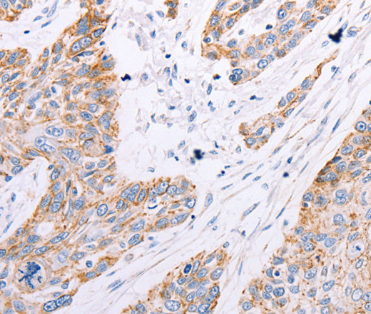 GFRA3 Polyclonal Antibody (E-AB-15686)