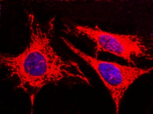 Recombinant AK4/Adenylate Kinase 4/AK3L1 Monoclonal Antibody (AN300420P)