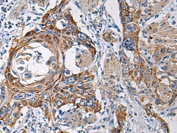 RITA1 Polyclonal Antibody (E-AB-19212)