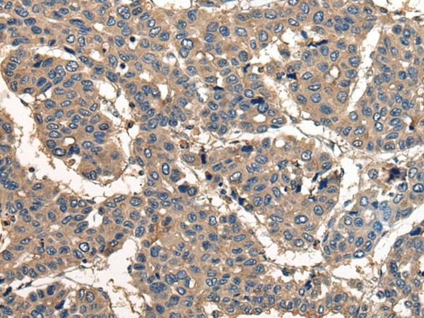 CORO1B Polyclonal Antibody (E-AB-19721)