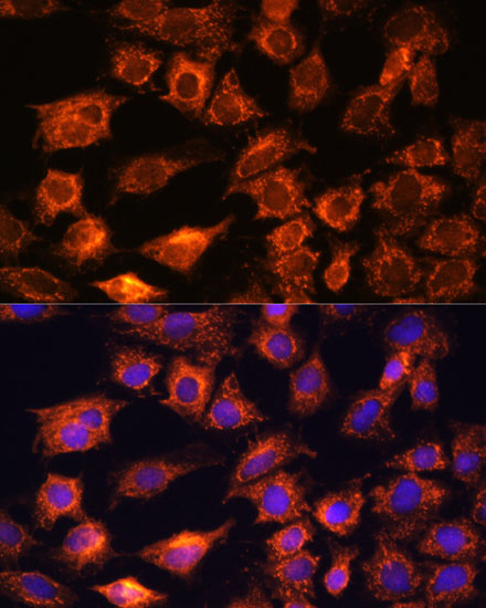PTCD1 Polyclonal Antibody (E-AB-66727)