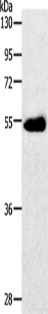 GLUT-3 Polyclonal Antibody (E-AB-15691)
