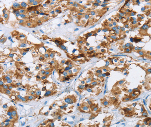 HINT2 Polyclonal Antibody (E-AB-10363)
