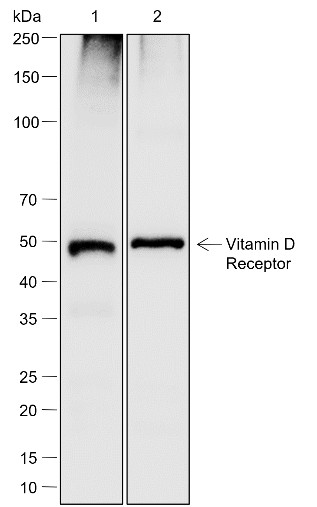 Recombinant Vitamin D Receptor Monoclonal Antibody (AN302069L)