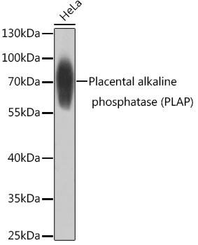 Placental alkaline phosphatase (PLAP) Polyclonal Antibody (E-AB-92361)