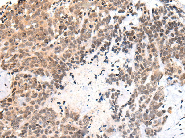 C14orf169 Polyclonal Antibody (E-AB-19635)