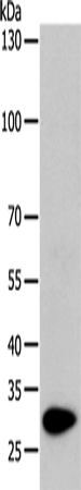 TPM1 Polyclonal Antibody (E-AB-14422)