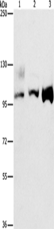 ASCC2 Polyclonal Antibody (E-AB-16227)