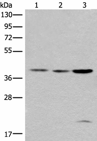 ROM1 Polyclonal Antibody (E-AB-52607)