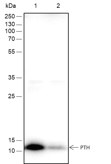 Recombinant PTH Monoclonal Antibody (AN301642L)
