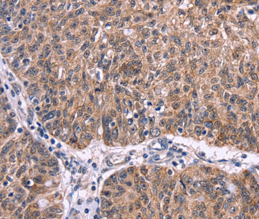 Ephrin A5 Polyclonal Antibody (E-AB-16408)