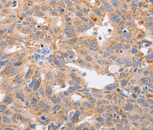 PPP1CB Polyclonal Antibody (E-AB-14304)