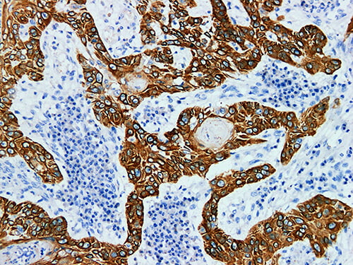 CK5 Monoclonal Antibody (ELAB6626-M)