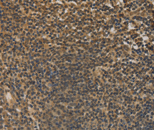 DACH1 Polyclonal Antibody (E-AB-11135)