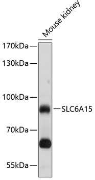 SLC6A15 Polyclonal Antibody (E-AB-90166)