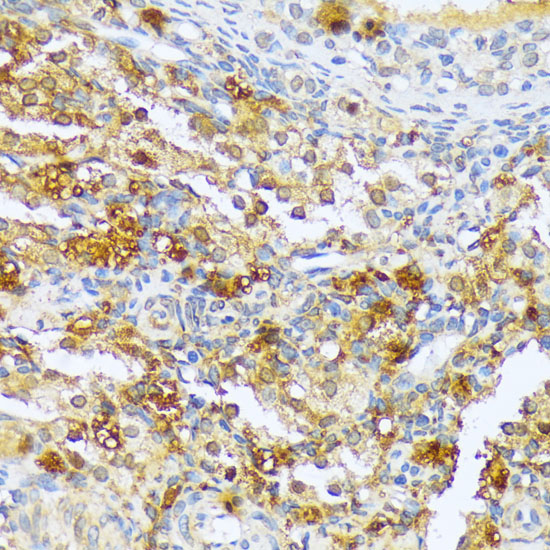 A1CF Polyclonal Antibody (E-AB-66005)