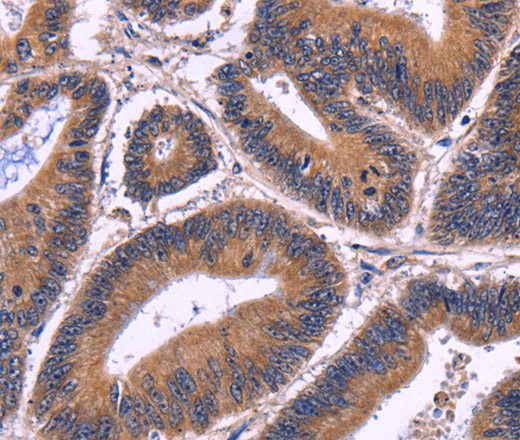 SPATA7 Polyclonal Antibody (E-AB-14378)